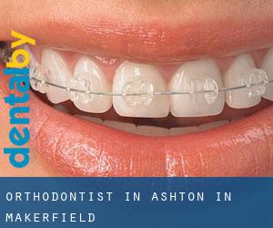Orthodontist in Ashton in Makerfield Orthodontist in Ashton in Makerfield