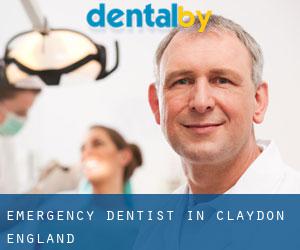 Emergency Dentist in Claydon (England)