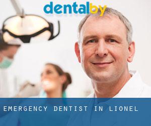 Emergency Dentist in Lionel