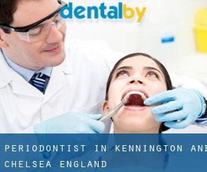 Periodontist in Kennington and Chelsea (England)