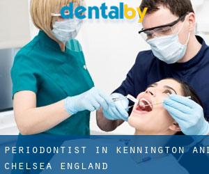 Periodontist in Kennington and Chelsea (England)