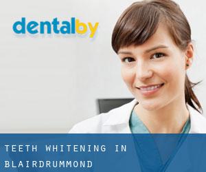 Teeth whitening in Blairdrummond