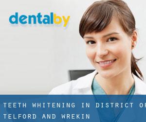 Teeth whitening in District of Telford and Wrekin