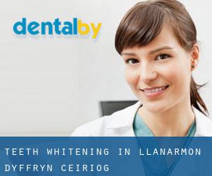 Teeth whitening in Llanarmon Dyffryn-Ceiriog