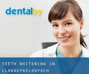Teeth whitening in Llandefaelogfâch