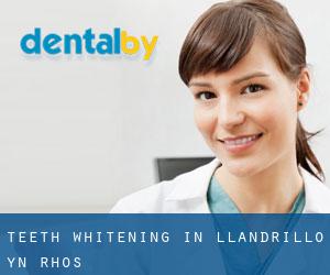 Teeth whitening in Llandrillo-yn-Rhôs