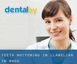 Teeth whitening in Llanelian-yn-Rhôs