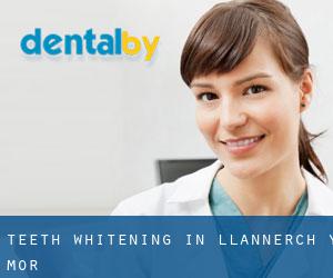 Teeth whitening in Llannerch-y-môr