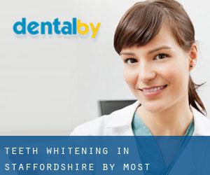 Teeth whitening in Staffordshire by most populated area - page 2