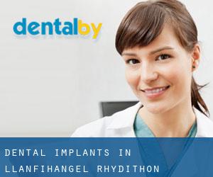 Dental Implants in Llanfihangel Rhydithon