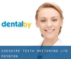Cheshire Teeth Whitening Ltd (Poynton)