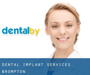 Dental Implant Services (Brompton)