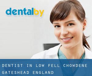 dentist in Low Fell & Chowdene (Gateshead, England)